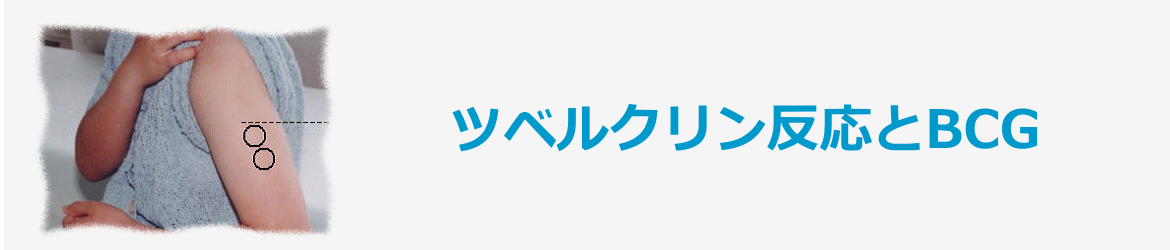 ツベルクリン反応とBCG